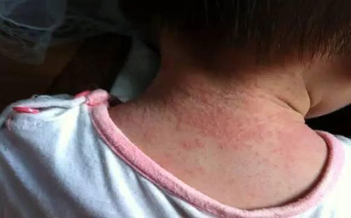 ������ô���� �������Ӹ���ô��